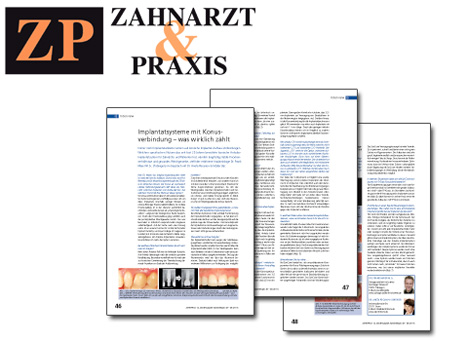 Zahngesundheit im Loretto Tübingen Zahnimplantate - Interview Collage