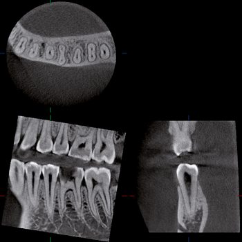 röntgengeräten, digitales röntgen, zähne, Zahngesundheit im loretto, implantat, Zahnimplantate, Zähne, Implantologie, Tübingen